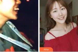 安徽天鵝湖口腔醫(yī)院張永莉整形價(jià)格表附牙綜合案例展示