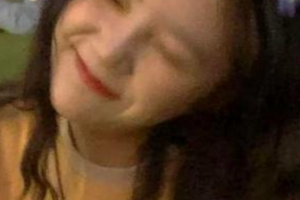 西安華旗唯美醫(yī)療美容門診部趙鵬飛整形價格表附金屬托槽矯正案例展示