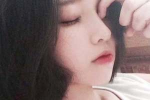 西安華仁醫(yī)院整形美容中心耿延鵬整形價格表附激光祛斑案例展示