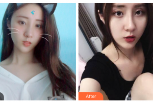 西安瑞麗斯美容整形醫(yī)院任華整形價(jià)格表附激光祛斑案例展示