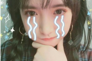 西安藝星醫(yī)療整形美容醫(yī)院宋蔚1整形價(jià)格表附玻尿酸精華導(dǎo)入案例展示