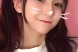 西安新銳植發(fā)醫(yī)療美容門診部張宗雨整形價格表附種植發(fā)際線案例展示