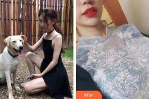 合肥福華醫(yī)療美容醫(yī)院柳大烈整形價(jià)格表附自體脂肪隆胸案例展示