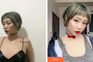 合肥麗人女子醫(yī)院中韓整形美容中心姜哲順整形價(jià)格表附自體脂肪隆胸案例展示