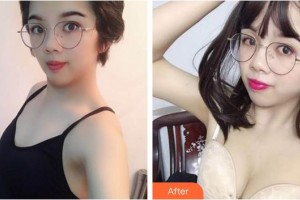 合肥大韓整形美容醫(yī)院楊軍叢整形價(jià)格表附自體脂肪隆胸案例展示