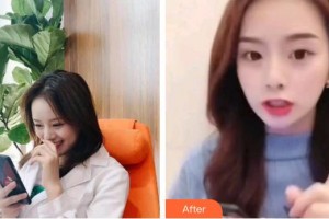 合肥崔勁松醫(yī)療美容診所崔瑩瑩整形價(jià)格表附超聲波潔牙案例展示