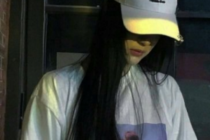 西安小白兔口腔醫(yī)院張俊霞整形價(jià)格表附牙貼面案例展示