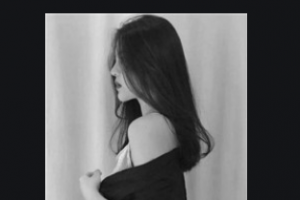 西安小白兔口腔醫(yī)院尚晶晶整形價(jià)格表附隱形托槽矯正案例展示