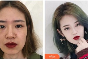 合肥麗人女子醫(yī)院中韓整形美容中心王松整形價格表附眼部綜合案例展示