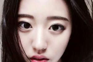 長沙雅美醫(yī)療美容醫(yī)院朱志軍整形價格表附光子嫩膚案例展示