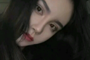 長沙愛思特醫(yī)療美容醫(yī)院陶婭整形價格表附埋線提升案例展示