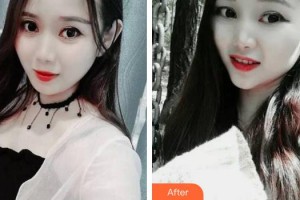 合肥佳德口腔門(mén)診部王炳節(jié)整形價(jià)格表附牙齒矯正案例展示