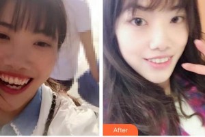 合肥拜博口腔醫(yī)院胡庚濤整形價(jià)格表附牙齒陶瓷矯正案例展示