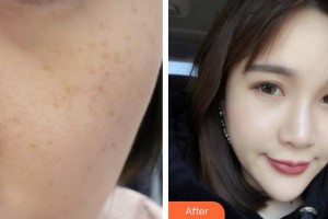 蕪湖瑞麗醫(yī)療美容門(mén)診部樊喜林整形價(jià)格表附超激光美膚案例展示