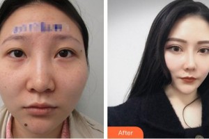 蕪湖瑞麗醫(yī)療美容門(mén)診部戴露倢整形價(jià)格表附眼部案例展示