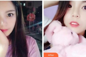 蕪湖市口腔醫(yī)院金紅軍整形價(jià)格表附牙齒隱形矯正案例展示