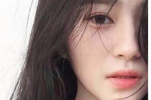 長(zhǎng)沙伊百麗醫(yī)學(xué)美膚連鎖肖湘整形價(jià)格表附玻尿酸豐面頰案例展示