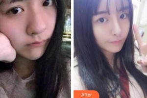 蚌埠韓美美萊醫(yī)療美容門診部周娜整形價(jià)格表附熱瑪吉案例展示