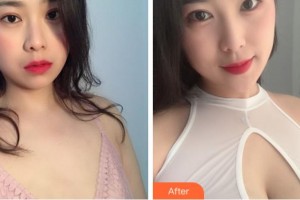 淮南麗人醫(yī)院整形美容科李化訓(xùn)整形價格表附自體脂肪隆胸案例展示
