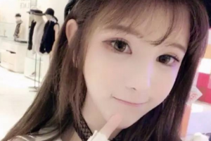 長沙希美醫(yī)療美容門診部易成鋼整形價格表附牙齒隱形矯正案例展示