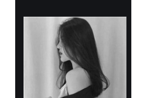 長沙麗都醫(yī)療美容醫(yī)院閔英俊整形價格表附金屬托槽矯正案例展示