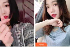 馬鞍山協(xié)志口腔門診部孫家齊整形價(jià)格表附牙齒矯正案例展示