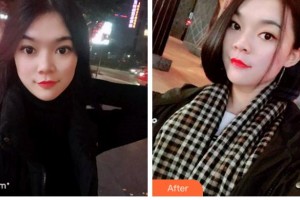 馬鞍山協(xié)志口腔門診部胡義元整形價(jià)格表附牙齒隱形矯正案例展示