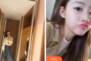 馬鞍山協(xié)志口腔門診部李海春整形價(jià)格表附牙齒隱形矯正案例展示