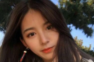 長沙雅美醫(yī)療美容醫(yī)院王健華整形價格表附種植發(fā)際線案例展示