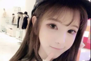 長沙南湖和睦整形醫(yī)院劉金榮整形價格表附自體脂肪豐面頰案例展示