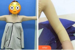 淮北東方美萊塢醫(yī)療美容醫(yī)院張莉整形價(jià)格表附美體塑形案例展示