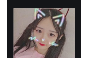 長(zhǎng)沙協(xié)雅整形美容醫(yī)院潘奇整形價(jià)格表附自體脂肪全臉填充案例展示