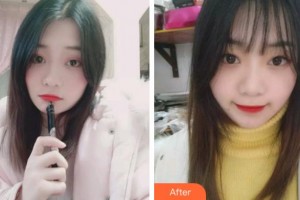 淮北博愛(ài)口腔醫(yī)院黃美玲整形價(jià)格表附牙齒隱形矯正案例展示