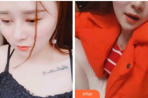 淮北口腔醫(yī)院黃鷙英整形價(jià)格表附超聲波潔牙案例展示