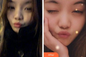 淮北口腔醫(yī)院王昊整形價(jià)格表附牙齒隱形矯正案例展示