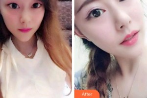 安慶渡江口腔醫(yī)院張良斌整形價格表附牙綜合案例展示