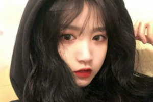 長沙愛爾眼科醫(yī)院羅麗佳整形價格表附切開雙眼皮案例展示