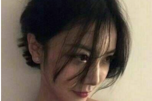 長沙愛爾眼科醫(yī)院王琦整形價格表附眼部綜合案例展示