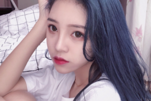 長沙湘江愛爾眼科醫(yī)院王啟常整形價格表附切開雙眼皮案例展示