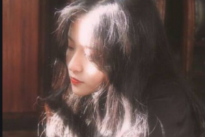 長沙好牙依口腔?？漆t(yī)院游福海整形價格表附眼部綜合案例展示