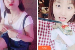 阜陽(yáng)愛(ài)齒口腔門(mén)診部蔣成坤整形價(jià)格表附美白劑美白牙齒案例展示