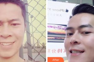 阜陽(yáng)愛(ài)齒口腔門(mén)診部韋磊整形價(jià)格表附金屬托槽矯正案例展示