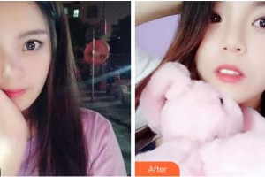 阜陽(yáng)愛(ài)齒口腔門(mén)診部趙艷整形價(jià)格表附牙齒矯正案例展示