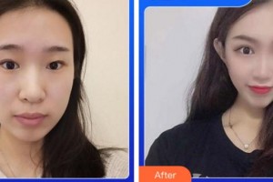 阜陽(yáng)澤明眼科醫(yī)院王利平整形價(jià)格表附眼部綜合案例展示