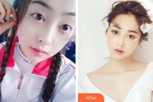 阜陽(yáng)福田眼科醫(yī)院王東偉整形價(jià)格表附眼部綜合案例展示