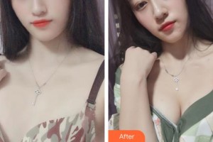 宿州康麗醫(yī)療美容門診部季輝整形價格表附豐胸案例展示