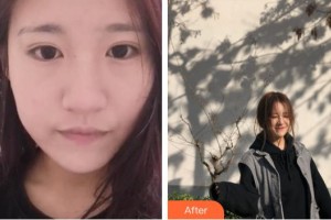 宿州漢密爾頓醫(yī)學美容醫(yī)院張躍偉整形價格表附嫩膚案例展示