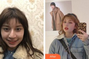 六安市人民醫(yī)院醫(yī)學美容中心李傳勇整形價格表附眼部整形案例展示