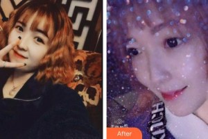 亳州嚴秀口腔診所王傲杰整形價格表附超聲波潔牙案例展示