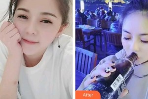 池州肖學(xué)忠口腔診所肖學(xué)忠整形價(jià)格表附冷光美白案例展示